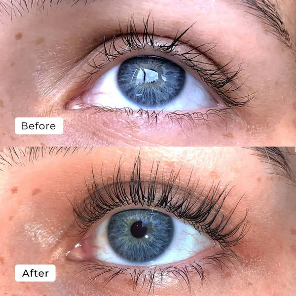 LashCharm™ Eyelash Growth Serum | 1 + 1 GRATIS