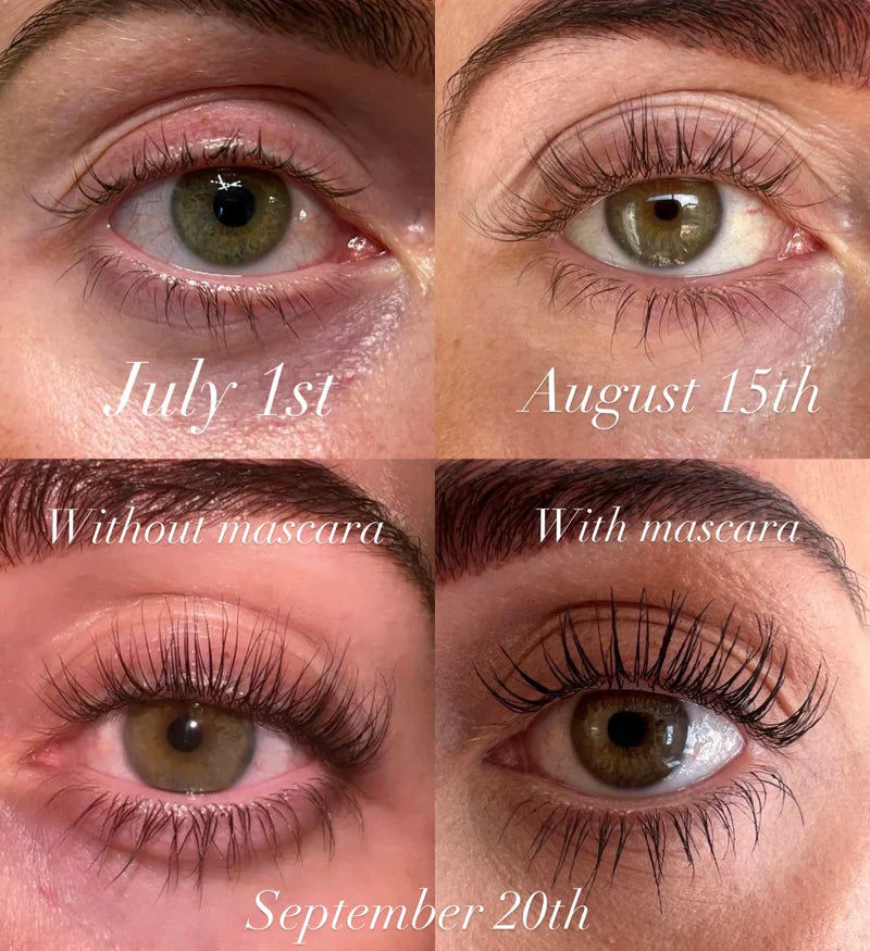 GlamLash™ Wimpergroeiserum | 1 + 1 GRATIS