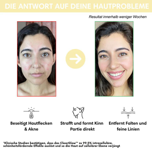 70% Rabatt | ClearGlow™ - Jugendliches Aussehen in nur 10 Minuten!