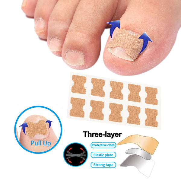 ToeRestore™ nagelcorrectiepleisters - 10 stuks (1 + 1 gratis)