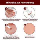 1+1 gratis! - SkinSmooth ™ tags en molverwijderaar