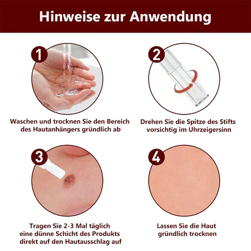 1+1 Gratis! - SkinClear™ Tags & Maulwurfsentferner