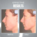 EvoFit™ Elektrisches Muskelstimulationsgerät zur Gesichtskonturanhebung (50% RABATT)